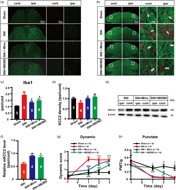 BDNF-TrkB signaling pathway-mediated microglial activation induces neuronal KCC2 downregulation contributing to dynamic allodynia following spared nerve injury.