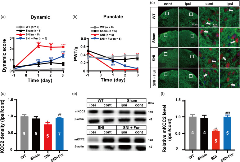 BDNF-TrkB signaling pathway-mediated microglial activation induces neuronal KCC2 downregulation contributing to dynamic allodynia following spared nerve injury.