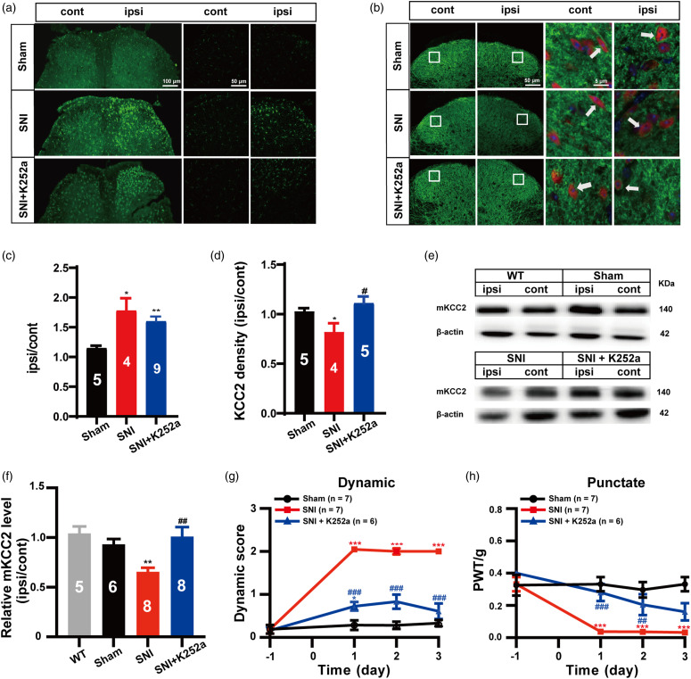 BDNF-TrkB signaling pathway-mediated microglial activation induces neuronal KCC2 downregulation contributing to dynamic allodynia following spared nerve injury.