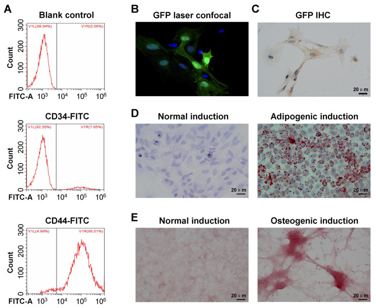 SDF-1 induces directional chemotaxis of BMSCs at the intervertebral fusion site and promotes osteogenic differentiation by regulating Wnt/β-catenin in the bone marrow chimera spinal intervertebral fusion mouse model.