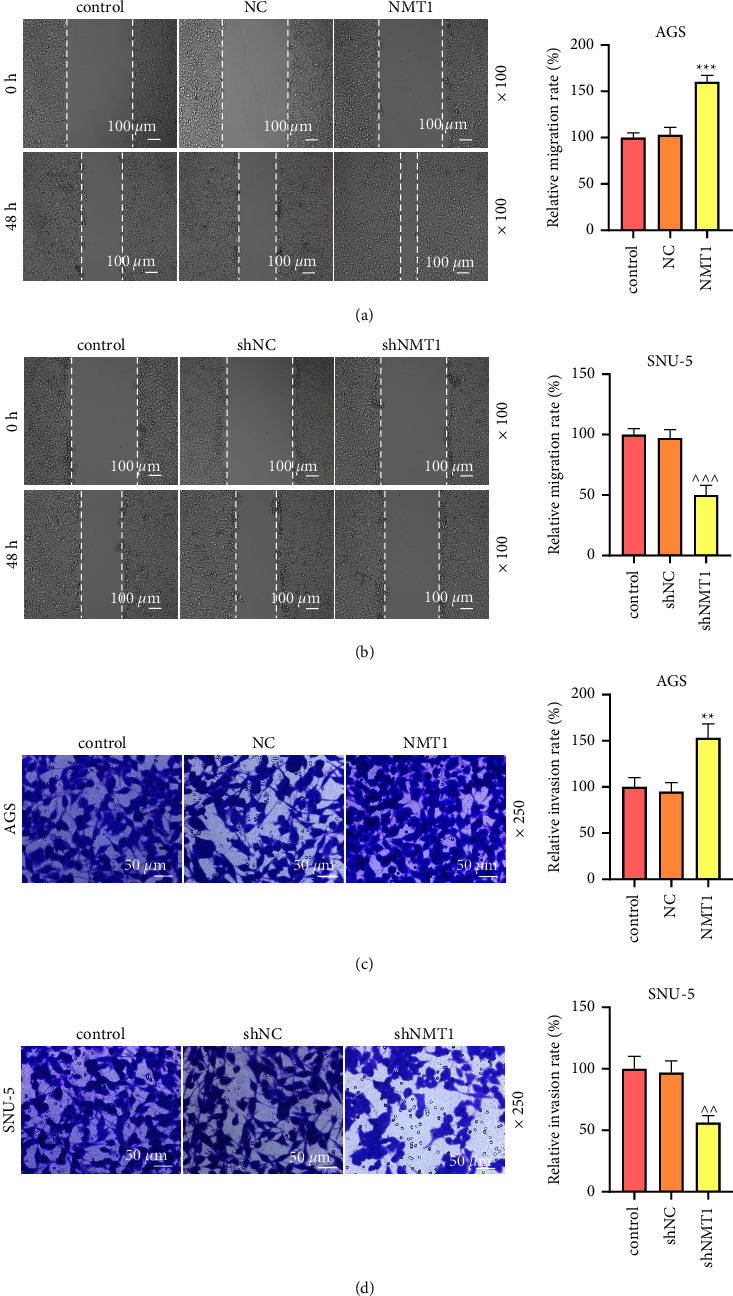 SPI1 Mediates N-Myristoyltransferase 1 to Advance Gastric Cancer Progression via PI3K/AKT/mTOR Pathway.