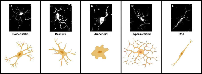 Microglial morphometric analysis: so many options, so little consistency.