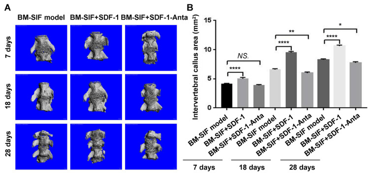 SDF-1 induces directional chemotaxis of BMSCs at the intervertebral fusion site and promotes osteogenic differentiation by regulating Wnt/β-catenin in the bone marrow chimera spinal intervertebral fusion mouse model.