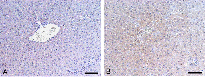 Gene expression analysis of antioxidant and DNA methylation on the rat liver after 4-week wood preservative chromated copper arsenate exposure.