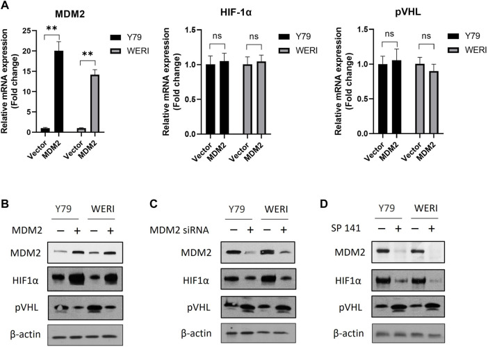 MDM2 promotes cancer cell survival through regulating the expression of HIF-1α and pVHL in retinoblastoma.