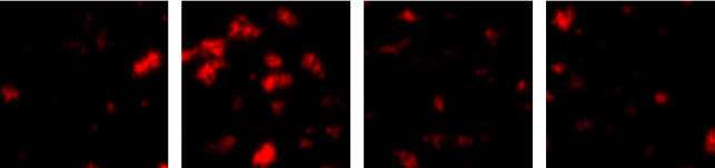 Effects of Walnut Bark Extract on the Human Platelet Aggregation, Adhesion, and Plasmatic Coagulation In Vitro.