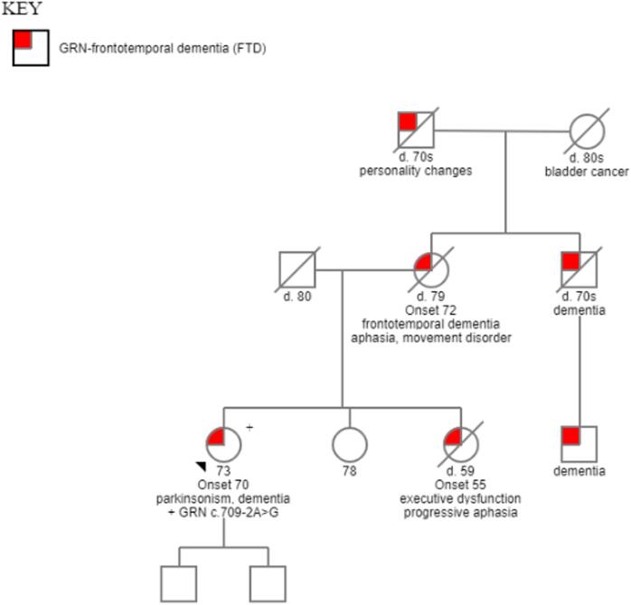 A case of familial frontotemporal dementia caused by a progranulin gene mutation