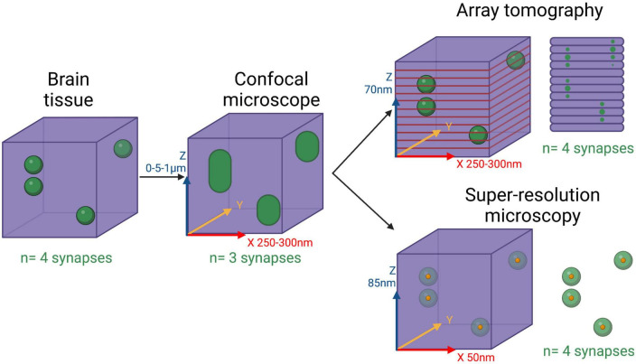 Bringing synapses into focus: Recent advances in synaptic imaging and mass-spectrometry for studying synaptopathy.