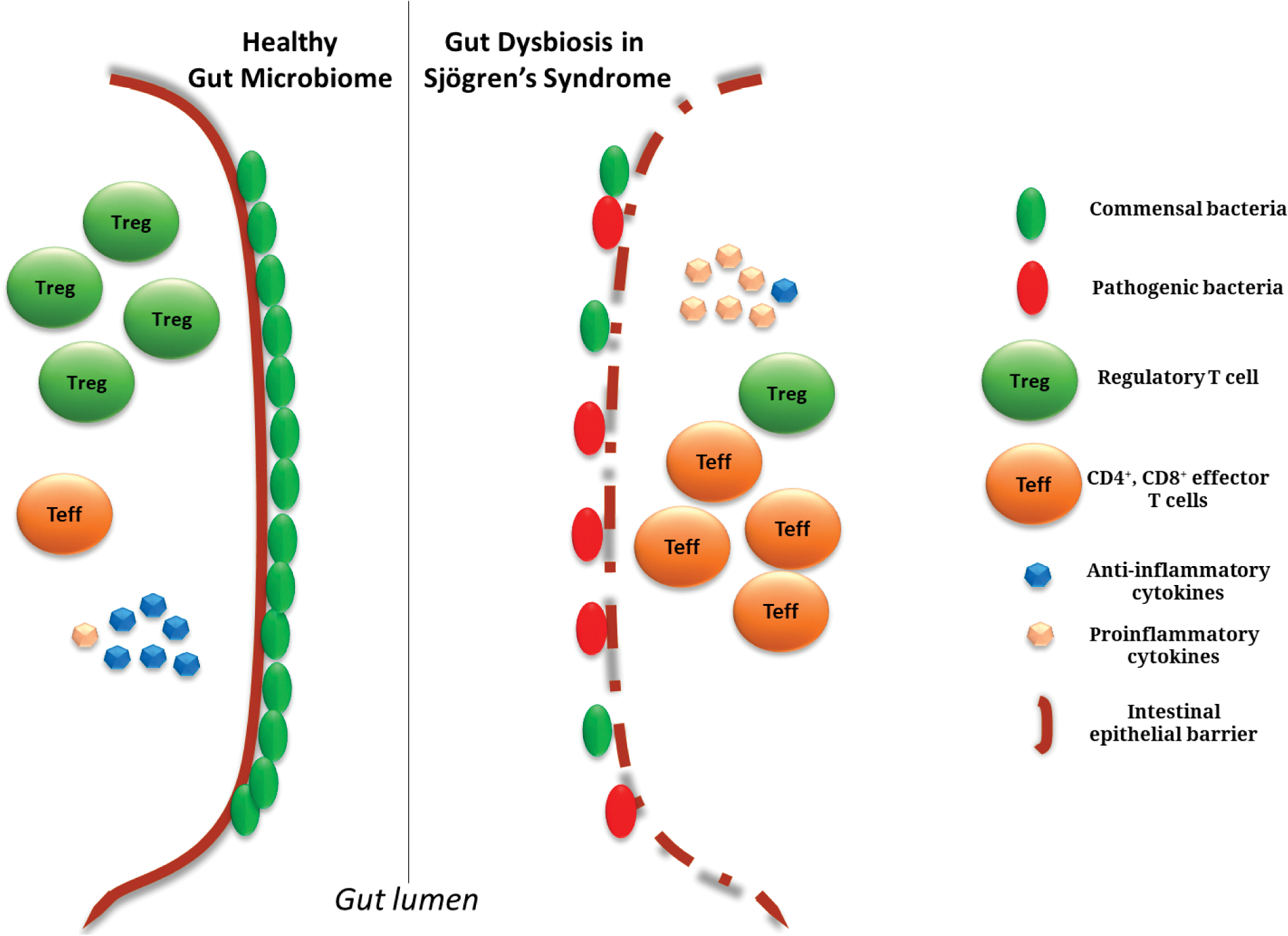 Sjögren's Syndrome Treatments in the Microbiome Era.