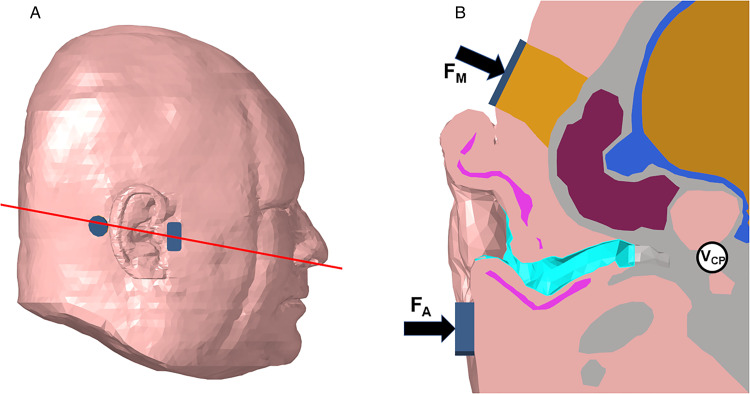 Hearing Through Bone Conduction Headsets.