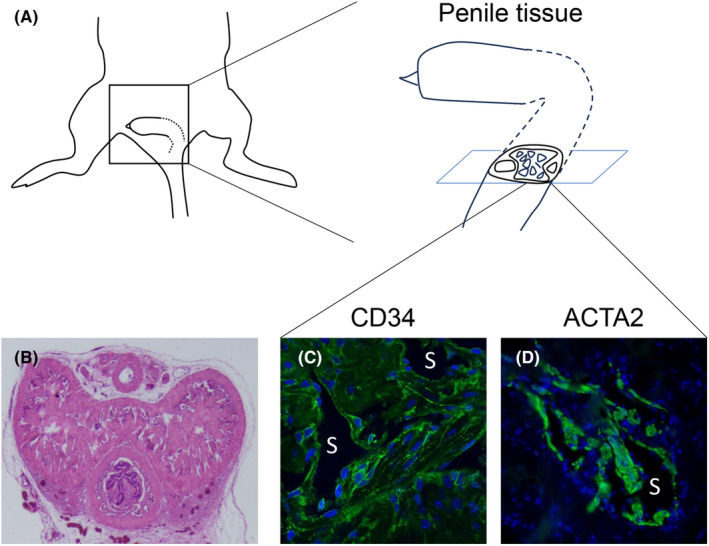 Emerging structural and pathological analyses on the erectile organ, corpus cavernous containing sinusoids.