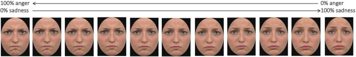 Testing EEG functional connectivity between sensorimotor and face processing visual regions in individuals with congenital facial palsy.