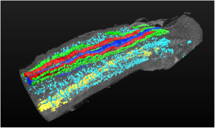 Emerging structural and pathological analyses on the erectile organ, corpus cavernous containing sinusoids.