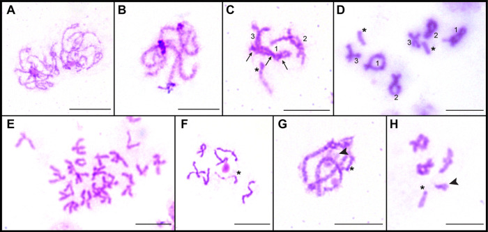 Chromosome analysis and the occurrence of B chromosomes in fish parasite Acanthocephalus anguillae (Palaeacanthocephala: Echinorhynchida).