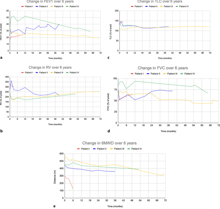 Severe Emphysema Treated with Bilateral Lung Sealant: A Case Series with Long-Term Follow-Up.