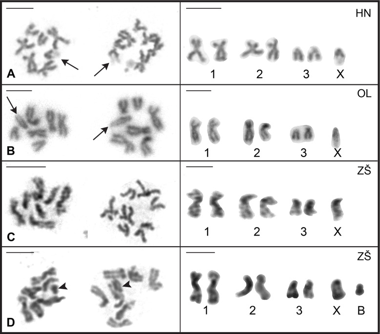 Chromosome analysis and the occurrence of B chromosomes in fish parasite Acanthocephalus anguillae (Palaeacanthocephala: Echinorhynchida).