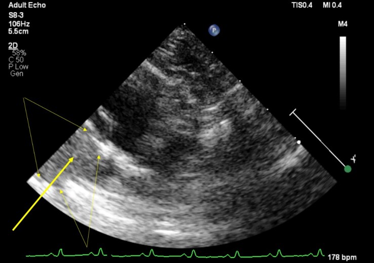 Successful early diagnosis and surgical treatment of congenital caval foramen hernia in an 8-month-old mixed breed cat.