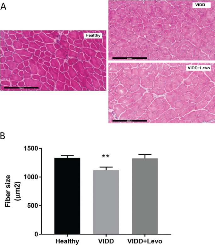 Treatment with levosimendan in an experimental model of early ventilator-induced diaphragmatic dysfunction.