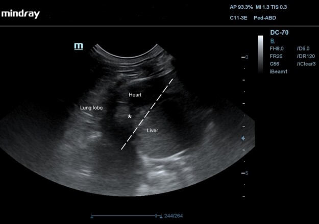 Successful early diagnosis and surgical treatment of congenital caval foramen hernia in an 8-month-old mixed breed cat.