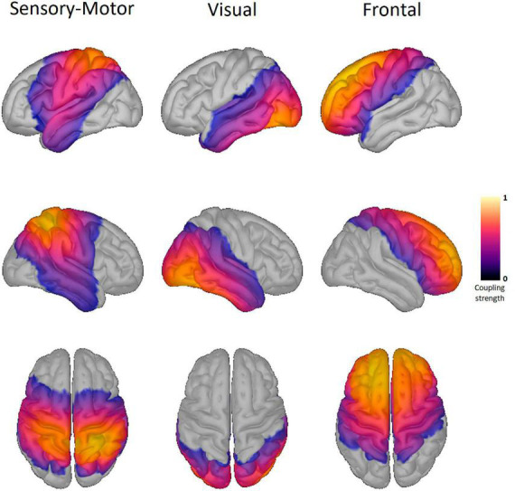 Alterations of PAC-based resting state networks in Parkinson's disease are partially alleviated by levodopa medication.