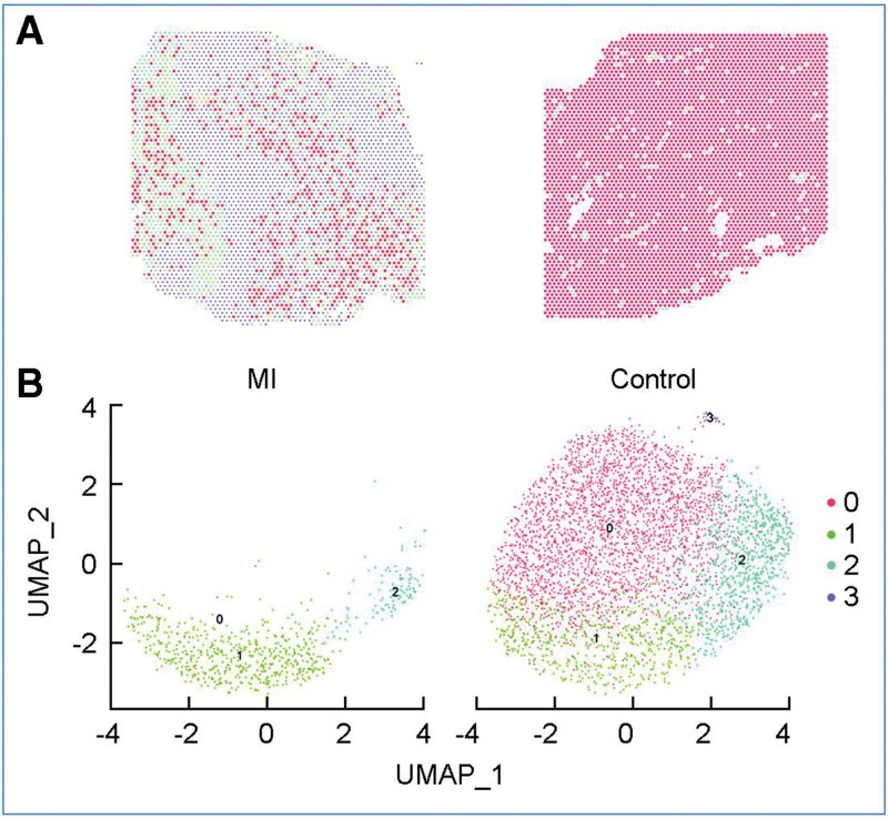 Identification of the metabolic state of surviving cardiomyocytes in the human infarcted heart by spatial single-cell transcriptomics.