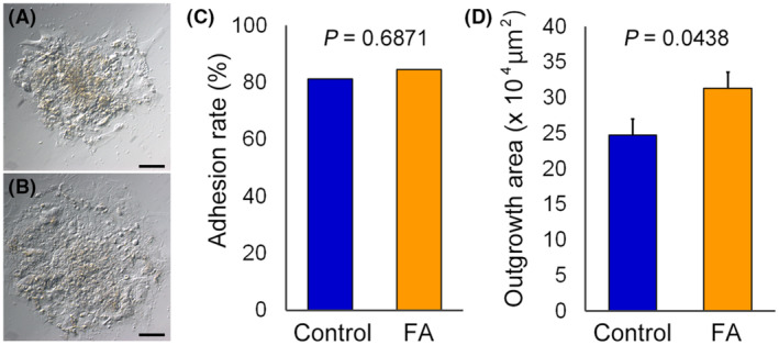 Fatty acid supplementation into warming solutions improves pregnancy outcomes after single vitrified-warmed cleavage stage embryo transfers.