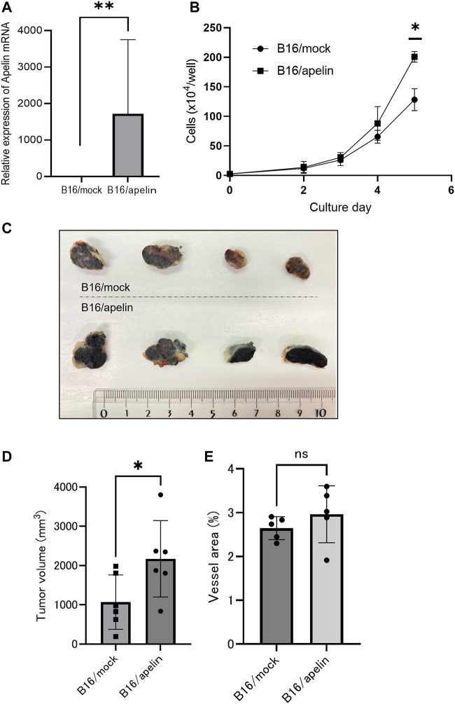 Cancer apelin receptor suppresses vascular mimicry in malignant melanoma.