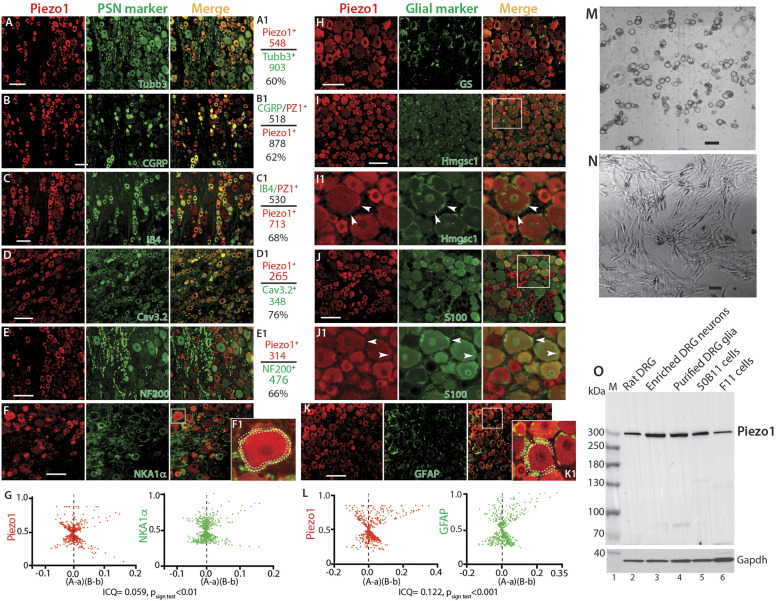 Peripheral sensory neurons and non-neuronal cells express functional Piezo1 channels.