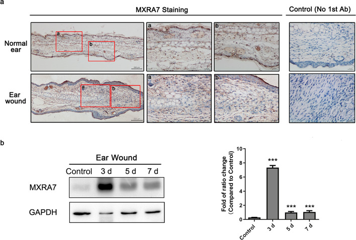 Matrix remodeling associated 7 proteins promote cutaneous wound healing through vimentin in coordinating fibroblast functions.