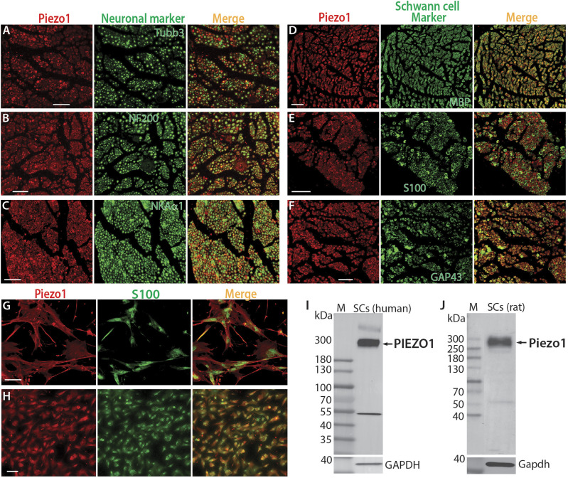 Peripheral sensory neurons and non-neuronal cells express functional Piezo1 channels.