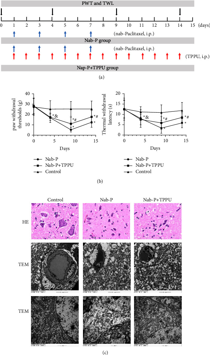 Soluble Epoxide Hydrolase Inhibitor TPPU Alleviates Nab-Paclitaxel-Induced Peripheral Neuropathic Pain via Suppressing NF-<i>κ</i>B Signalling in the Spinal Cord of a Rat.