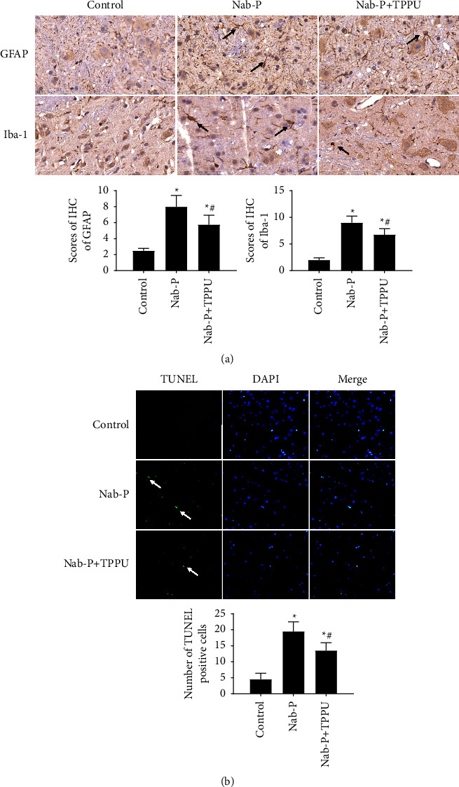 Soluble Epoxide Hydrolase Inhibitor TPPU Alleviates Nab-Paclitaxel-Induced Peripheral Neuropathic Pain via Suppressing NF-<i>κ</i>B Signalling in the Spinal Cord of a Rat.