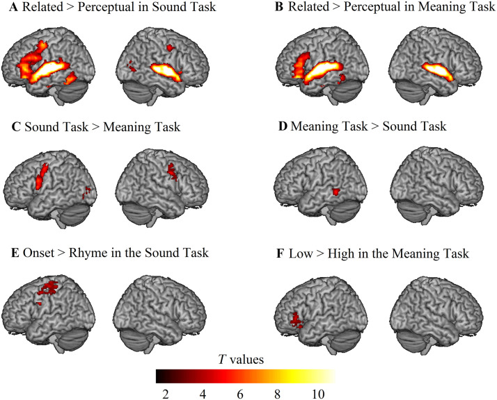 Phonological and Semantic Specialization in 9- to 10-Year-Old Children During Auditory Word Processing.