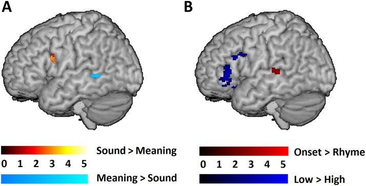 Phonological and Semantic Specialization in 9- to 10-Year-Old Children During Auditory Word Processing.