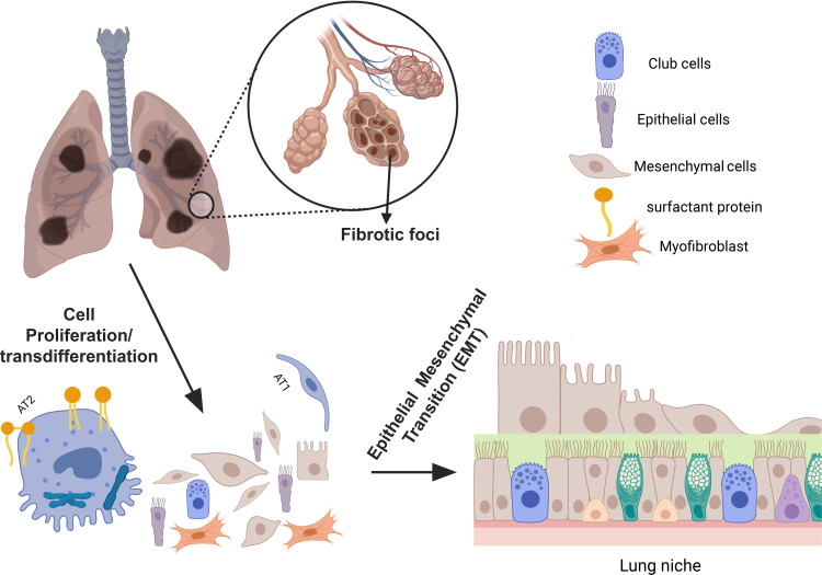 The Regenerative Power of Stem Cells: Treating Bleomycin-Induced Lung Fibrosis.