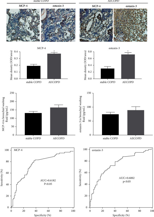 MCP-4 and Eotaxin-3 Are Novel Biomarkers for Chronic Obstructive Pulmonary Disease.