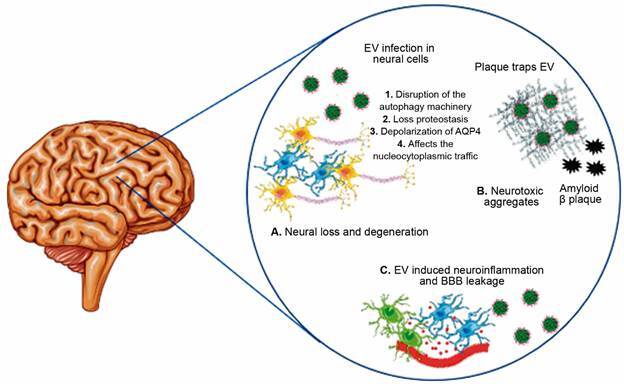 Enterovirus infection and its relationship with neurodegenerative diseases.