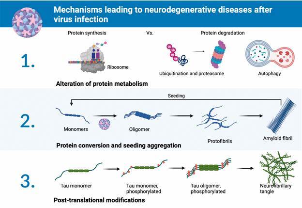 Enterovirus infection and its relationship with neurodegenerative diseases.