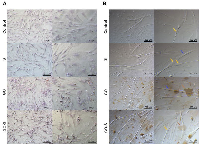 Graphene Oxide Decreases Pro-Inflammatory Proteins Production in Skeletal Muscle Cells Exposed to SARS-CoV-2 Spike Protein.