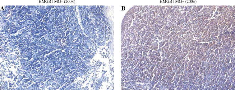 Downregulation of HMGB1 in thymoma cells affects T cell differentiation.