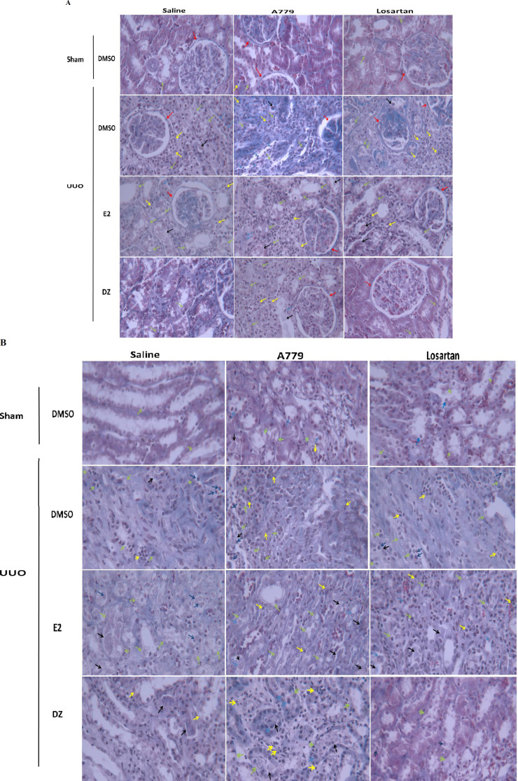 The effect of daidzein on renal injury in ovariectomized rats: interaction of angiotensin receptors and long non-coding RNAs H19, GAS5, MIAT, and Rian.