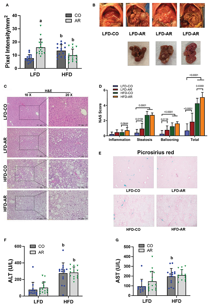 Investigating the effects of long-term Aroclor 1260 exposure on fatty liver disease in a diet-induced obesity mouse model.