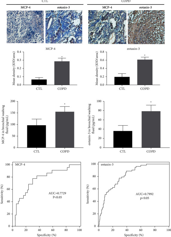 MCP-4 and Eotaxin-3 Are Novel Biomarkers for Chronic Obstructive Pulmonary Disease.