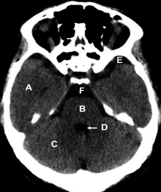 Sectional Anatomy Quiz-IΧ.