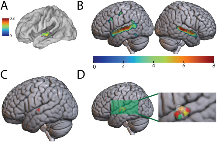 Evidence for a Spoken Word Lexicon in the Auditory Ventral Stream.