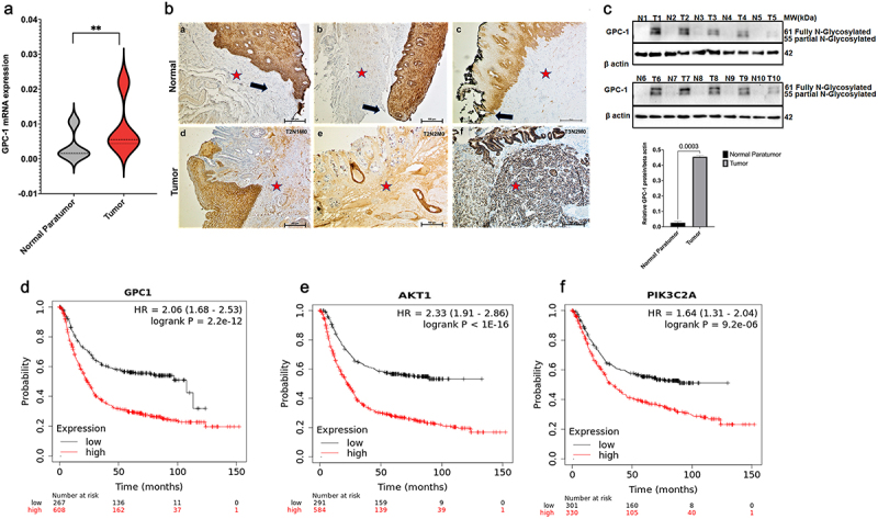 Silencing Glypican-1 enhances the antitumor effects of Pictilisib via downregulating PI3K/Akt/ERK signaling in chemo-resistant esophageal adenocarcinoma.