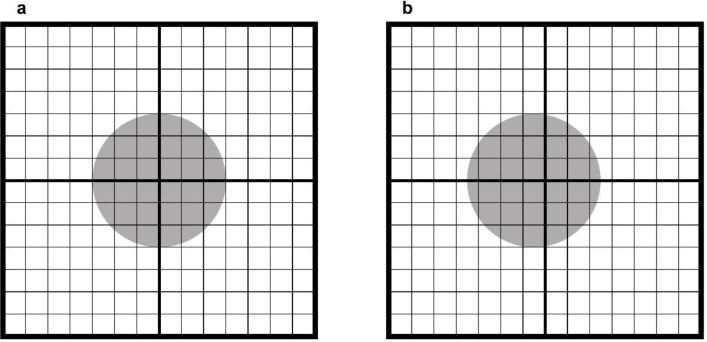 Effect of Tumor-Pixel Positioning on the Variability of SUV Measurements in PET Images.