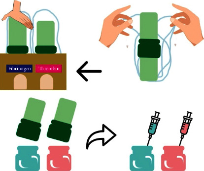 Endoscopic Management Using Novel Haemostatic Agents for Immediate Bleeding during Endoscopic Retrograde Cholangio-Pancreatography.