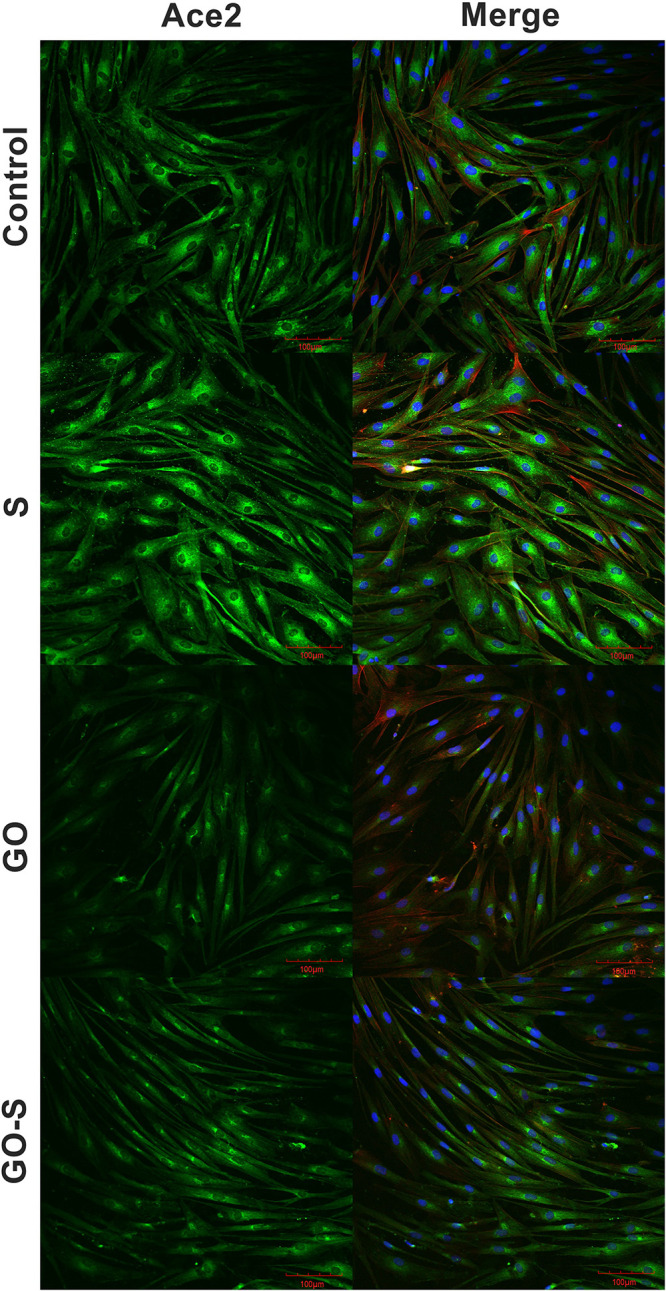 Graphene Oxide Decreases Pro-Inflammatory Proteins Production in Skeletal Muscle Cells Exposed to SARS-CoV-2 Spike Protein.