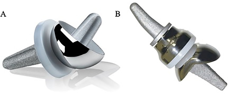 The Clinical Outcomes of Radiocapitellar Reconstruction With Radiocapitellar Arthroplasty: A Systematic Review and Meta-Analysis.